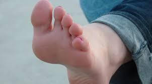 Hongos en los pies: cómo prevenir y tratar su aparición en verano