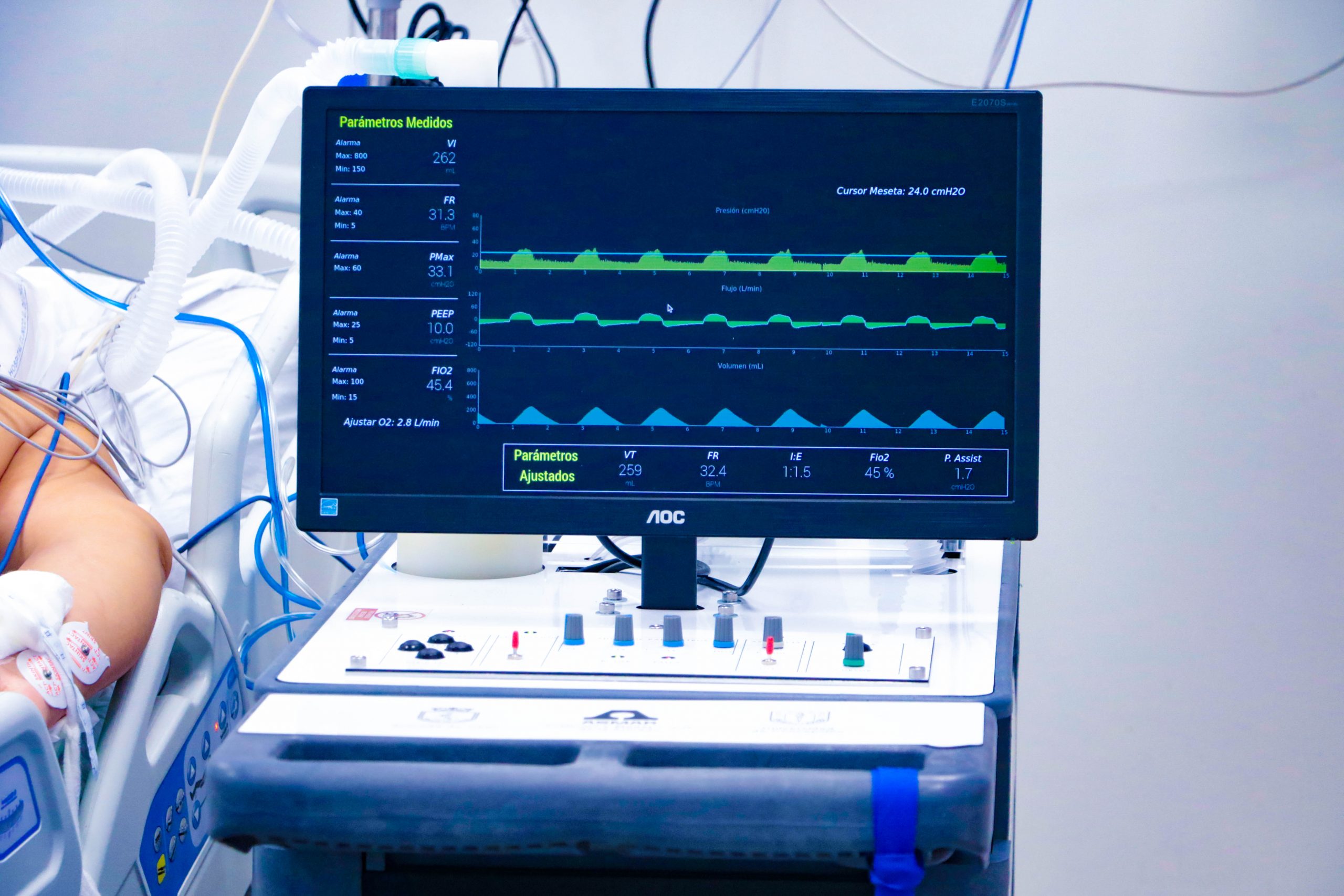 “Un Respiro para Chile”: Avanzan pruebas clínicas de ventiladores mecánicos fabricados en nuestro país