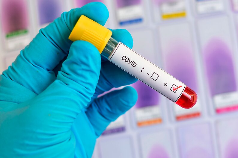 Hospital Clínico de la Universidad de Chile inicia tratamiento experimental con plasma en pacientes COVID-19