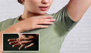 Hiperhidrosis: cuando la sudoración es excesiva￼