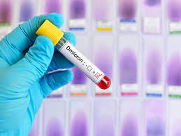 Variante BF.7 de Ómicron llegó a Chile: Tiene alta capacidad de propagación en adultos mayores