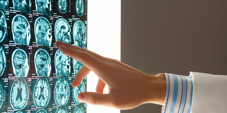 SSA y Hospital Regional de Antofagasta trabajan en la implementación de una Unidad de Neurointervencionismo para pacientes críticos con ACV
