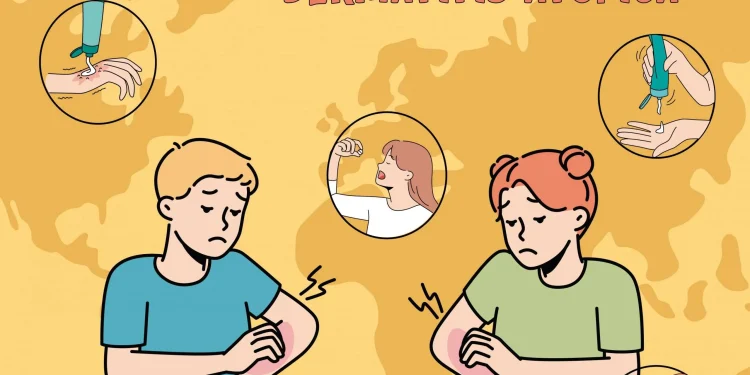 Altos costos y deterioro en la calidad de vida: especialistas alertan sobre la urgencia de cubrir la dermatitis atópica severa en la Ley Ricarte Soto