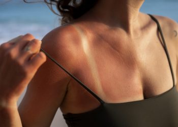 Verano y piel al límite: los problemas estéticos que más aumentan con el sol… y cómo prevenirlos 