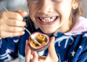 Más snacks y menos cepillado: Por qué aumentan las caries en niños en verano
